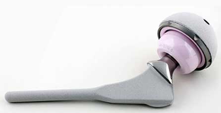 ceramic hip replacement