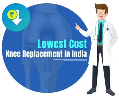 Lowest Cost Knee Replacement in India