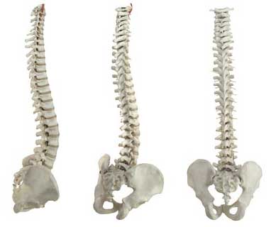 osteoporosis symptoms