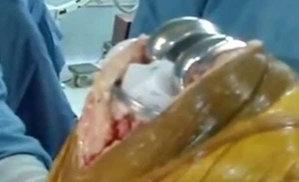 orthopaedicsindia
