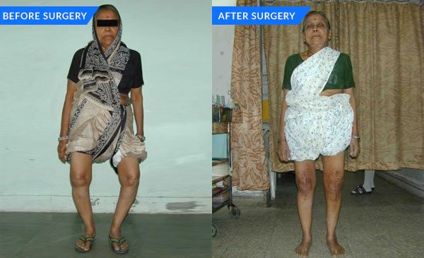 orthopaedicsindia