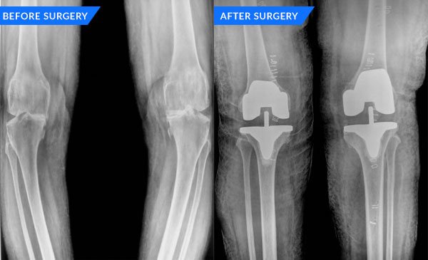 orthopaedicsindia