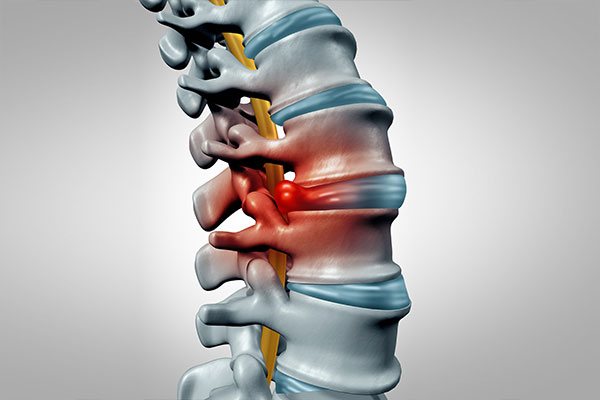orthopaedicsindia