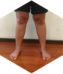 orthopaedicsindia