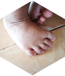 orthopaedicsindia