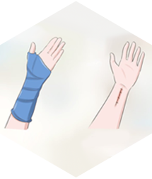 orthopaedicsindia