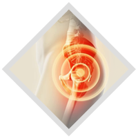 hip-replacement