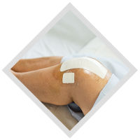 knee-replacement
